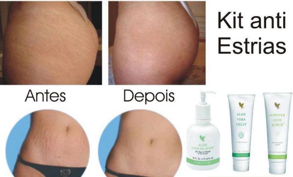 KIT TRATAMENTO PARA ESTRIAS