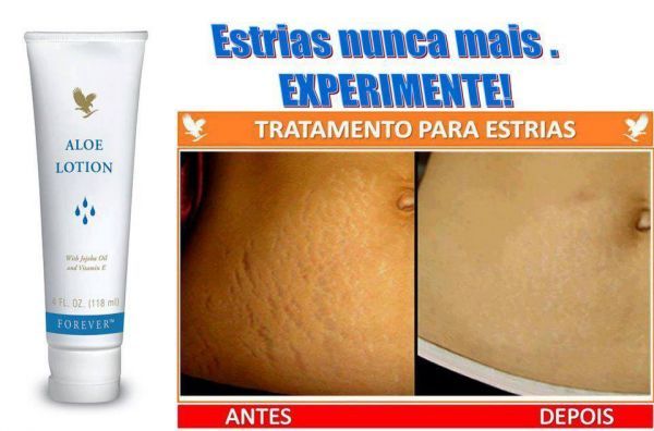 Aloe Lotion™