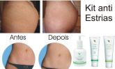 KIT TRATAMENTO PARA ESTRIAS
